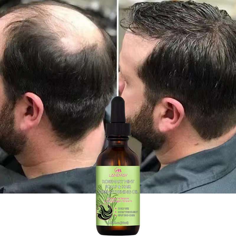 Hair Growth Oil Dense Hair Essential Oil Anti Hair Loss Nourishing Rosemary Smooth Nourishment Essential