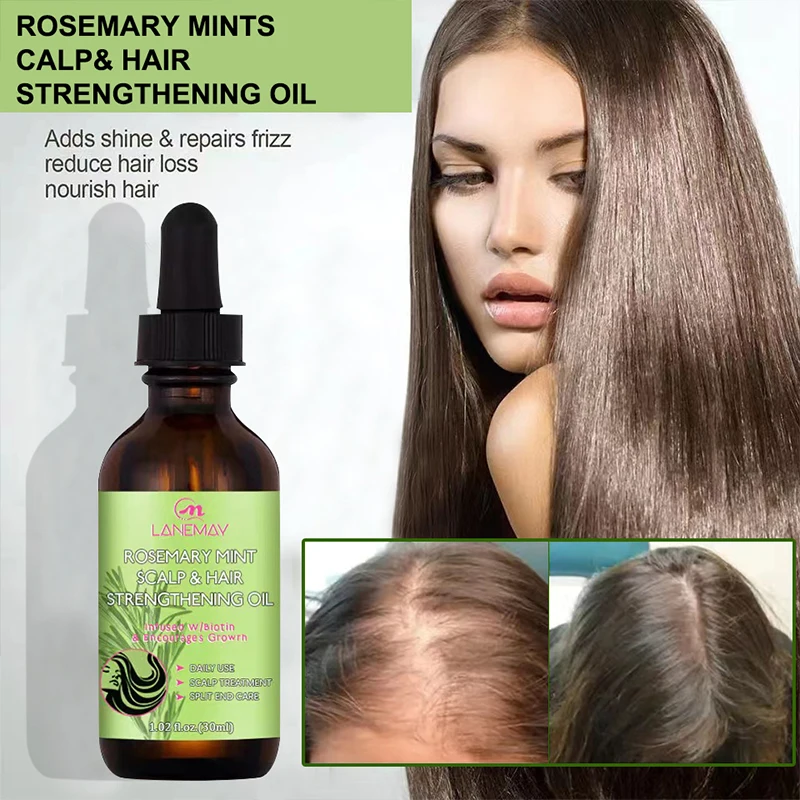 Hair Growth Oil Dense Hair Essential Oil Anti Hair Loss Nourishing Rosemary Smooth Nourishment Essential