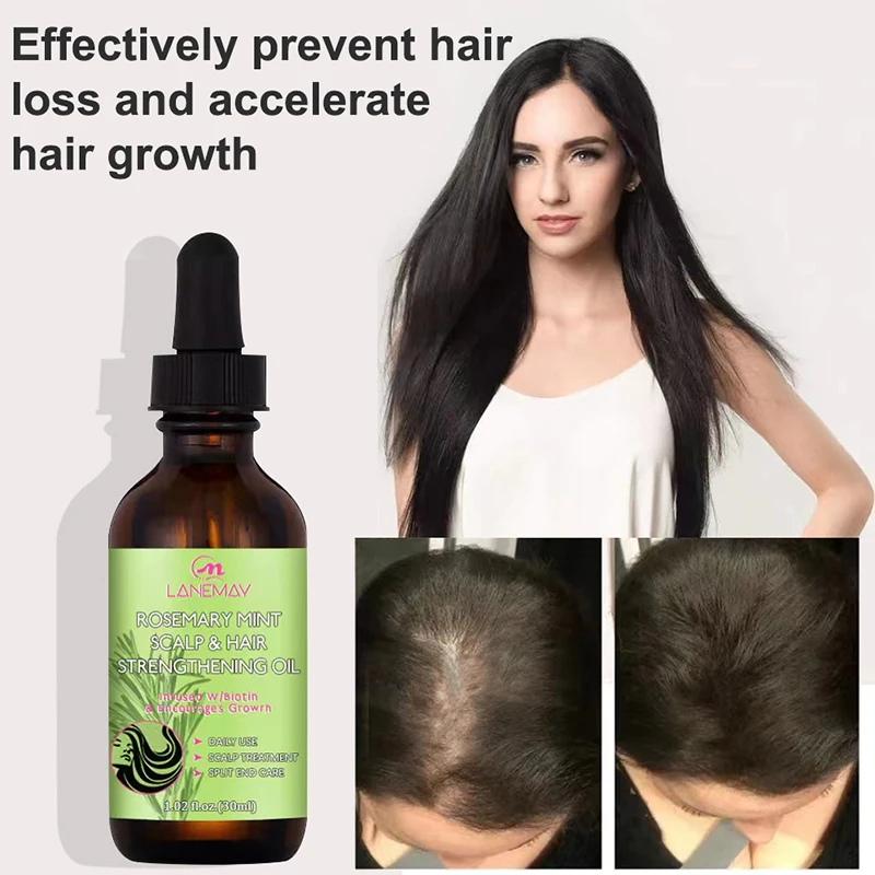 Hair Growth Oil Dense Hair Essential Oil Anti Hair Loss Nourishing Rosemary Smooth Nourishment Essential