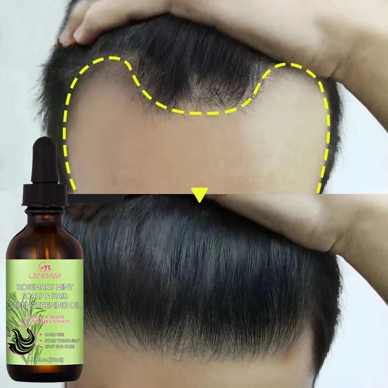 Hair Growth Oil Dense Hair Essential Oil Anti Hair Loss Nourishing Rosemary Smooth Nourishment Essential