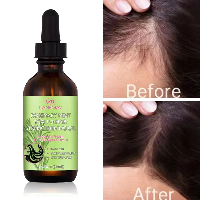 Hair Growth Oil Dense Hair Essential Oil Anti Hair Loss Nourishing Rosemary Smooth Nourishment Essential