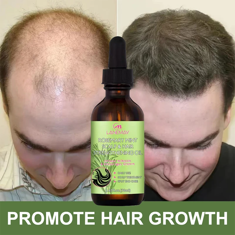 Hair Growth Oil Dense Hair Essential Oil Anti Hair Loss Nourishing Rosemary Smooth Nourishment Essential