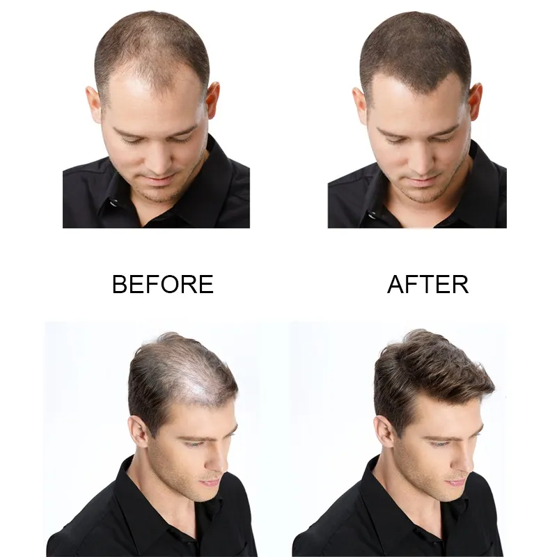 Hair Growth Oil Fast Hair Growth Products Scalp Treatments Prevent Hair Loss Thinning Beauty Hair Care for Men Women