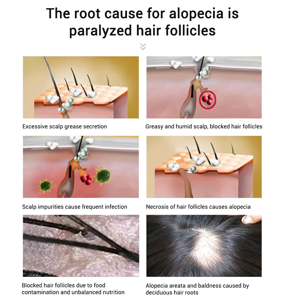 Hair Growth Oil Fast Hair Growth Products Scalp Treatments Prevent Hair Loss Thinning Beauty Hair Care for Men Women