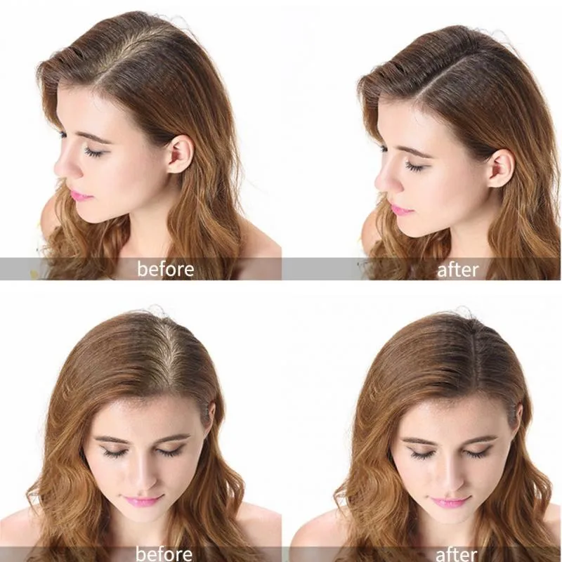 Hair Growth Oil Fast Hair Growth Products Scalp Treatments Prevent Hair Loss Thinning Beauty Hair Care for Men Women
