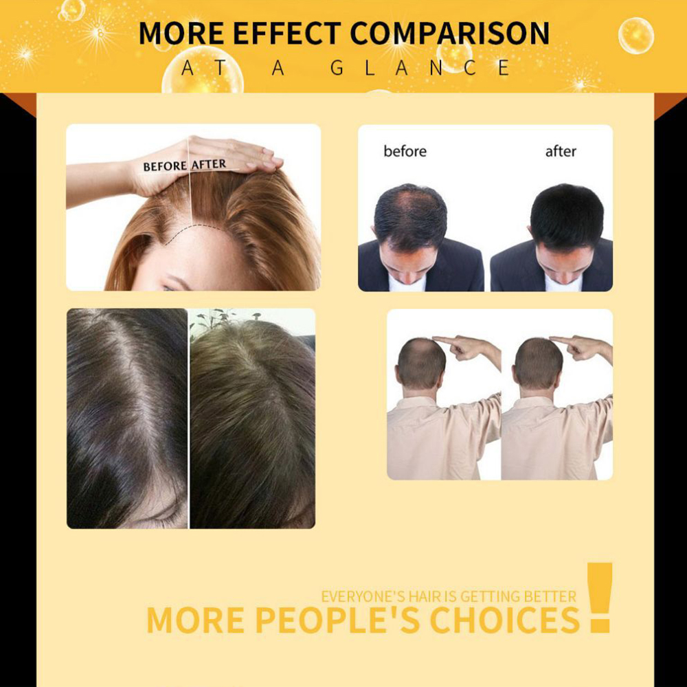Hair Growth Oil Hair Repair Serum Hair Growth Oil Hair Repair Serum