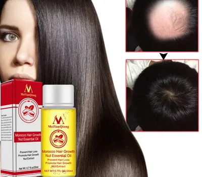 Hair Growth Serum Natural Treatment Hair Growth Serum Natural Treatment