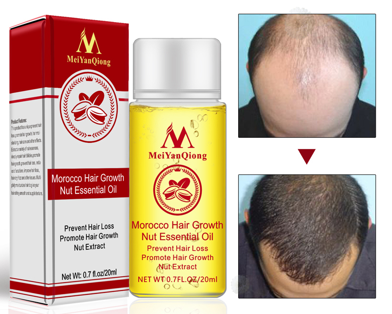 Hair Growth Serum Natural Treatment Hair Growth Serum Natural Treatment