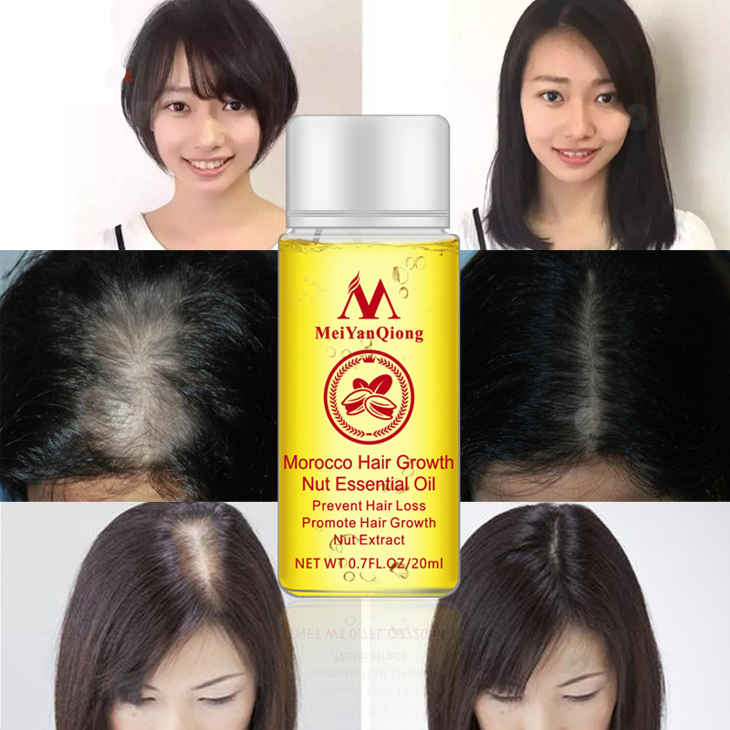 Hair Growth Serum Natural Treatment Hair Growth Serum Natural Treatment