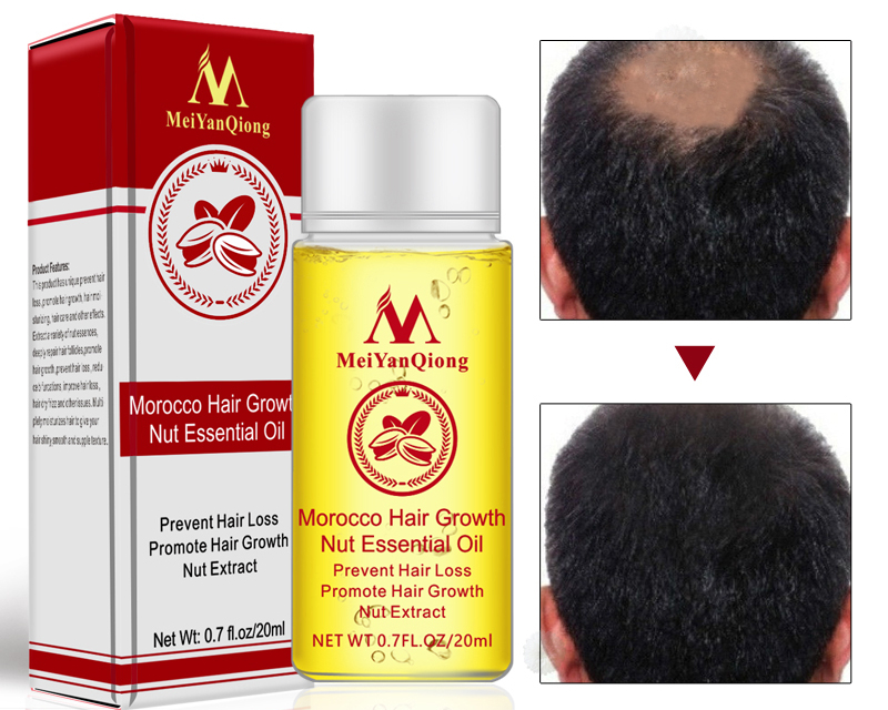 Hair Growth Serum Natural Treatment Hair Growth Serum Natural Treatment