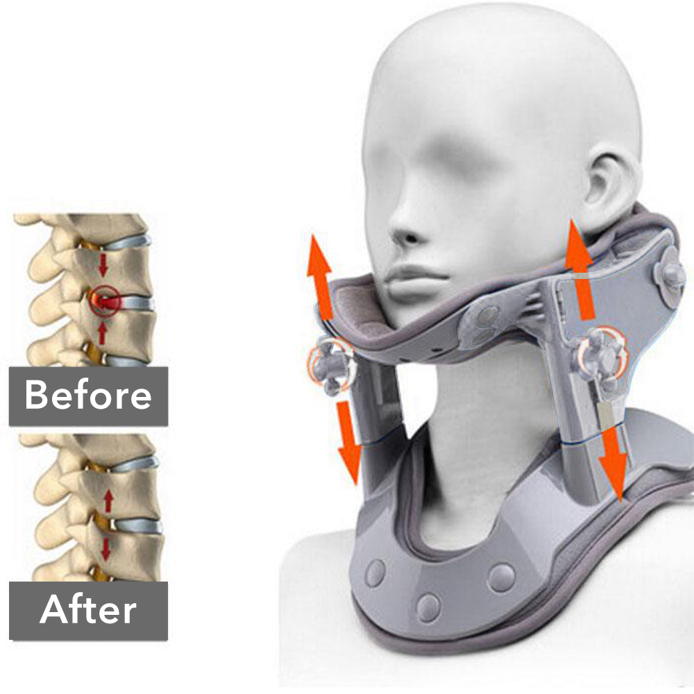 Heating Neck Collar Corrector Repair Cervical Traction Brace Apparatus Neck Posture Correction Treatment Cervical Spine