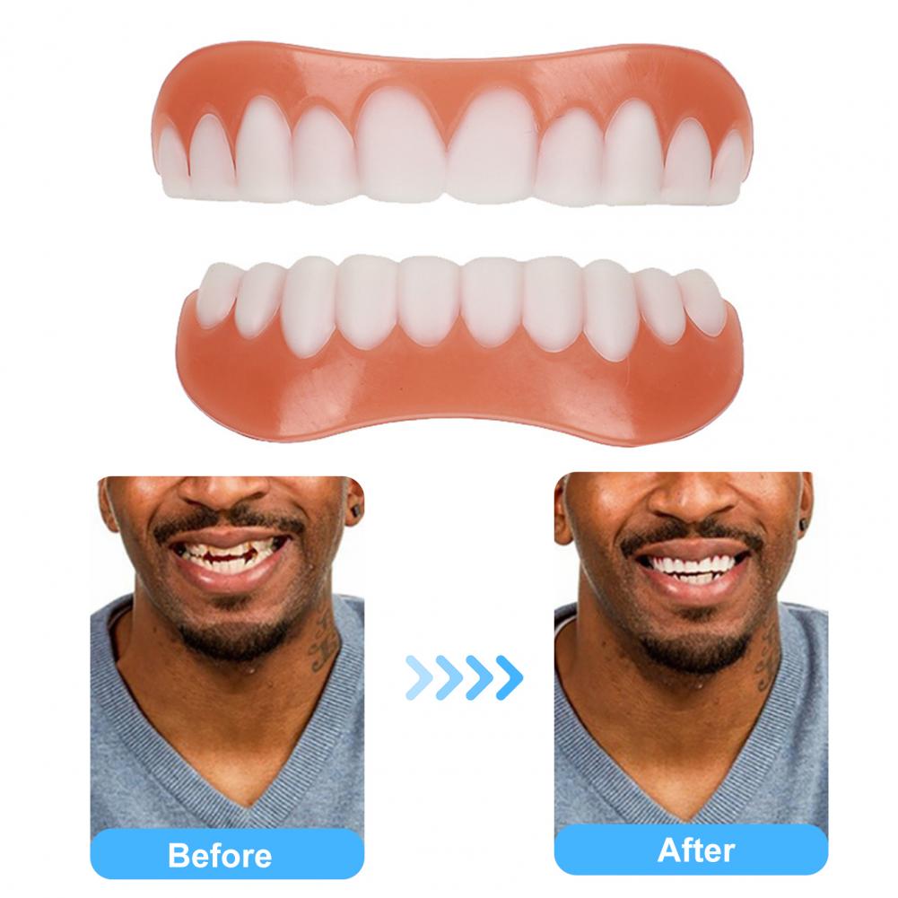 Helpful Fake Teeth Cover No Odor Safest Silicone Freedom to Smile Fake Teeth Cover Cosmetic Teeth Cover Special Helpful Fake Teeth Cover No Odor Safest Silicone Freedom to Smile Fake Teeth Cover Cosmetic Teeth Cover Special