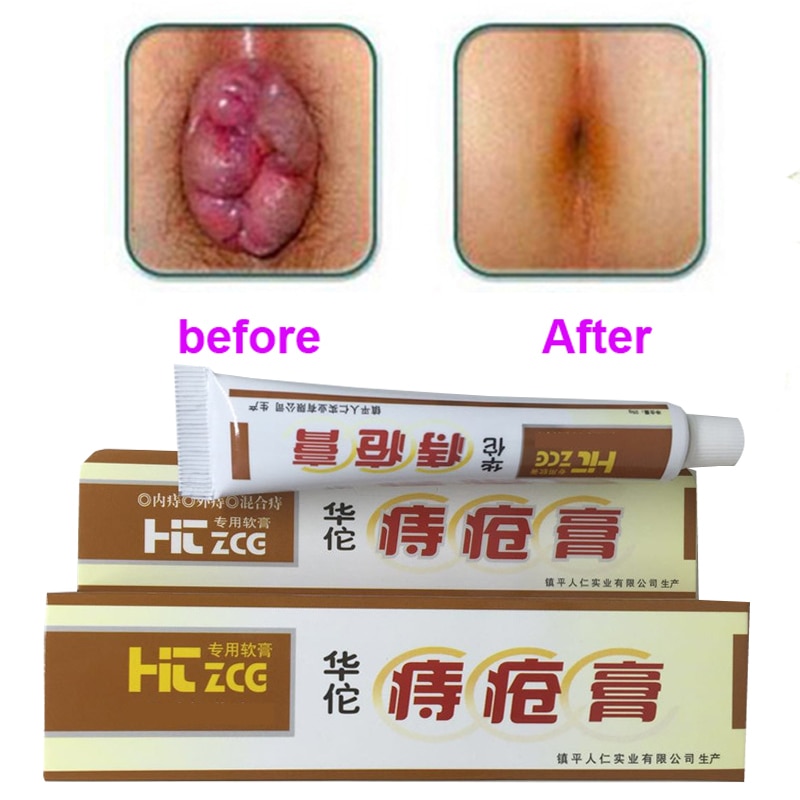 Hemorrhoid Ointment Soothing Cream