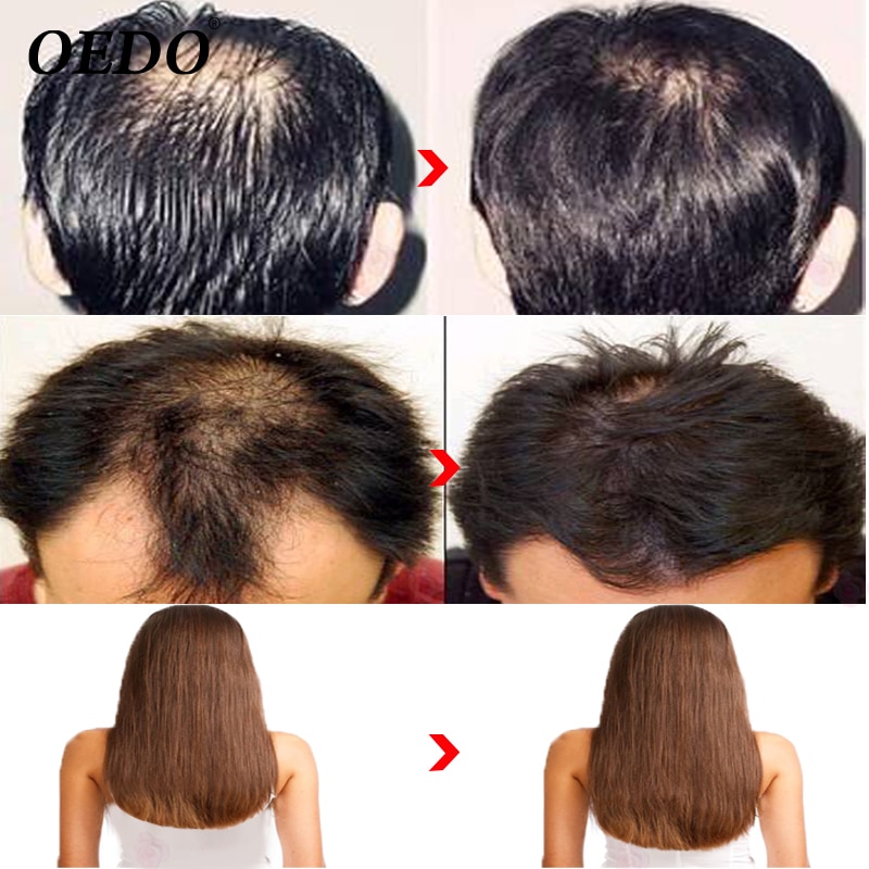 Herbal Ginseng Hair Growth Shampoo
