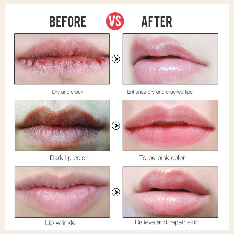 Honey Lip Balm Moisturizing Balm Honey Lip Balm Moisturizing Balm