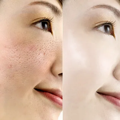 Hyaluronic Face Lifting Serum Hyaluronic Face Lifting Serum