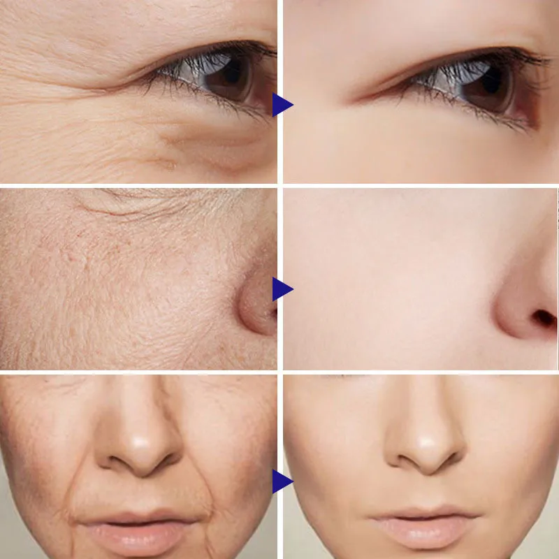 Instant Anti-aging Remove Wrinkle Cream Lifting Firm Fade Fine Lines Tighten Skin Whiten Brighten Moisturize Face Neck