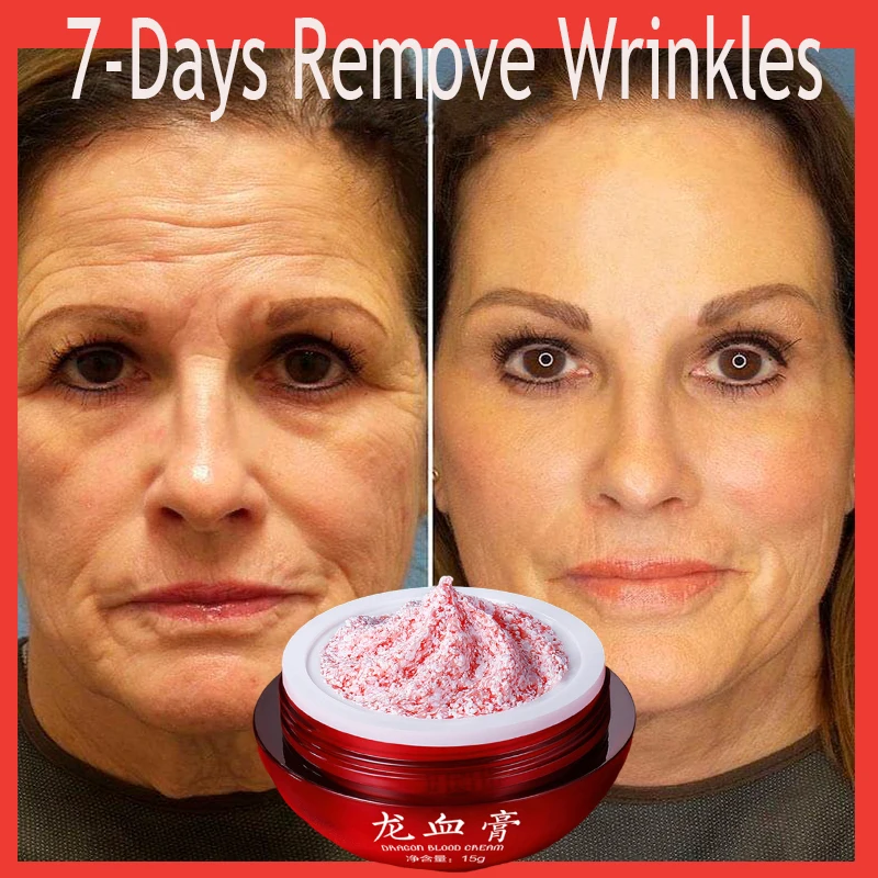 Instant Anti-aging Remove Wrinkle Cream Lifting Firm Fade Fine Lines Tighten Skin Whiten Brighten Moisturize Face Neck