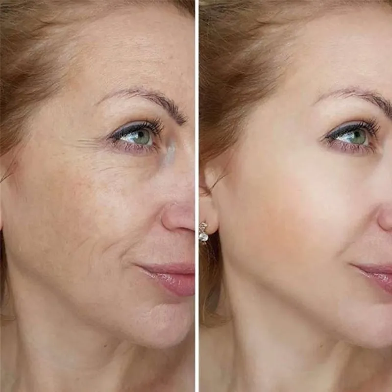 Instant Anti-aging Remove Wrinkle Cream Lifting Firm Fade Fine Lines Tighten Skin Whiten Brighten Moisturize Face Neck