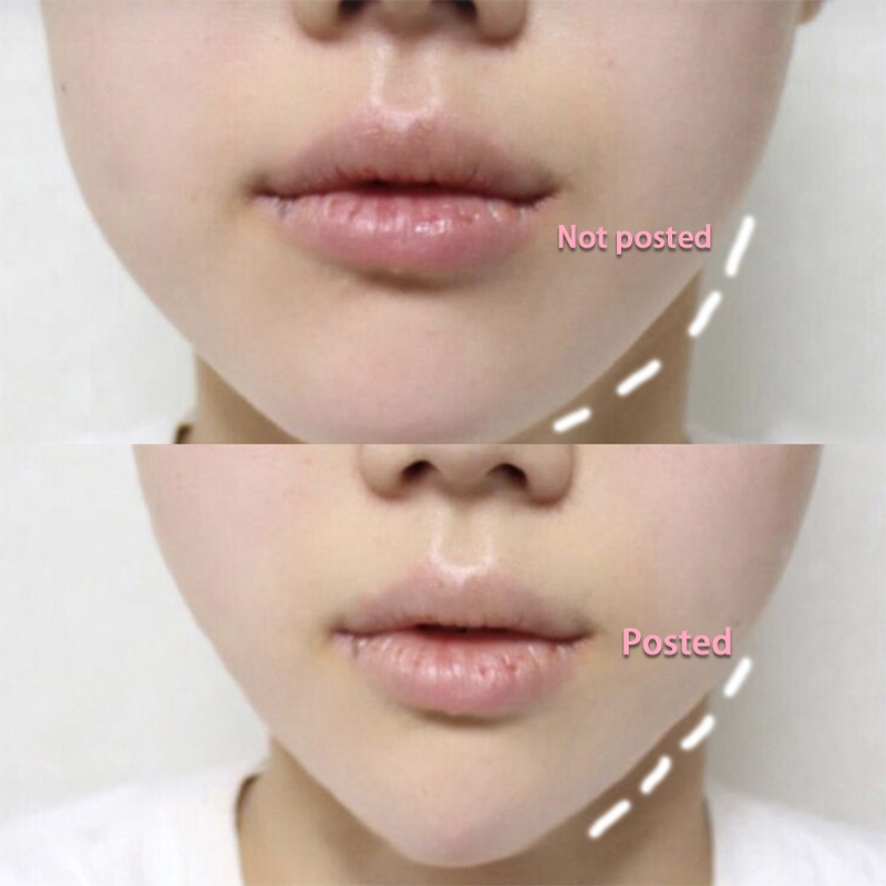 Instant Face Lift Tape with String Instant Face Lift Tape with String
