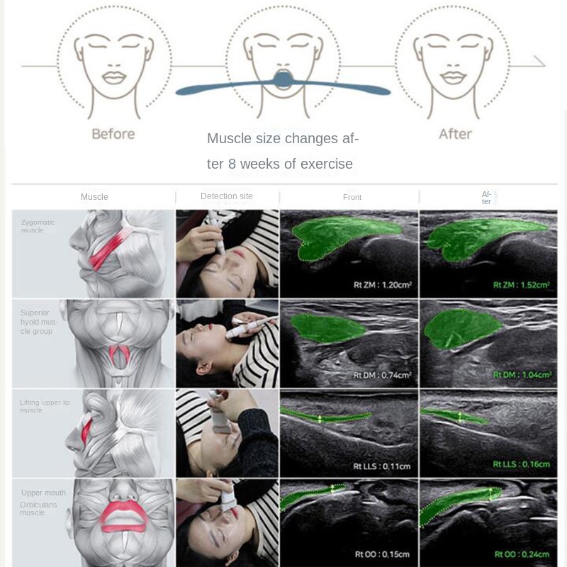 Jaw Exerciser Bite Muscle Training Face Lift V Face Thin Face Artifact Nasolabial Wrinkle Remover Double Chin Reducer