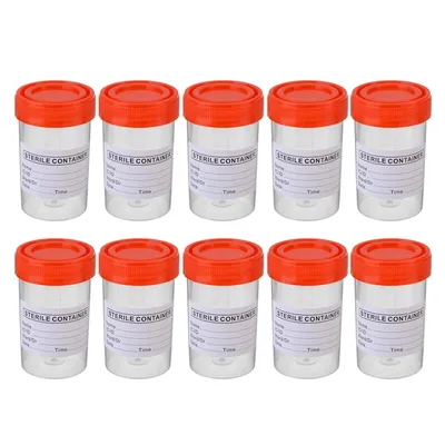 Labeled 60ml Specimen Bottles (10pcs)