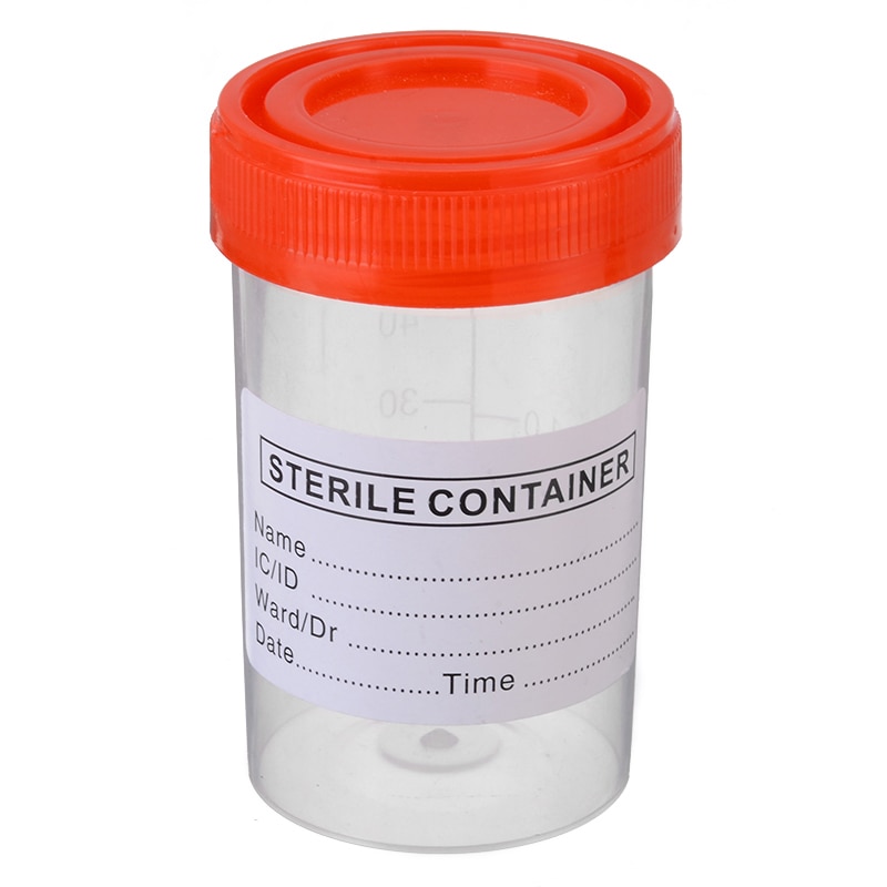 Labeled 60ml Specimen Bottles (10pcs)