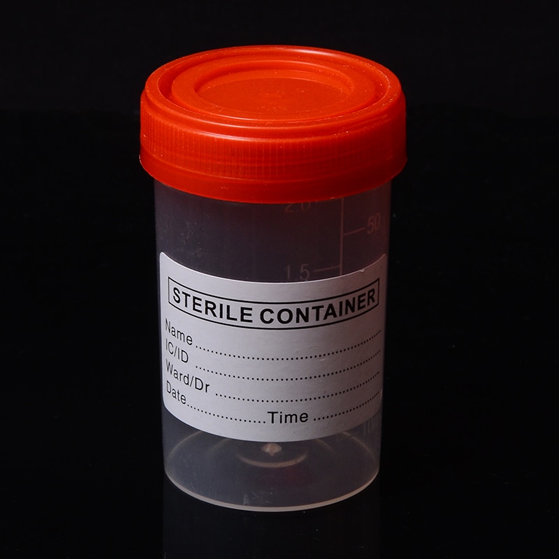 Labeled 60ml Specimen Bottles (10pcs)
