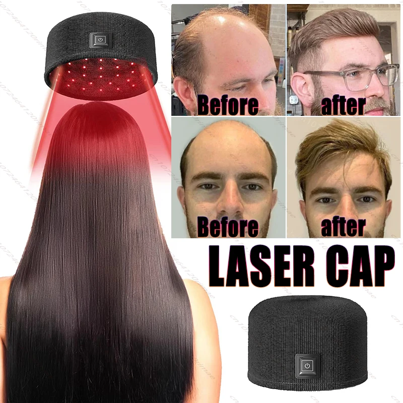 Laser Hair Cap Repairs Frizzy Hair, Thickens Hairline, Solidifies Head Massage, Cares for Damaged Hair, Heat Cap