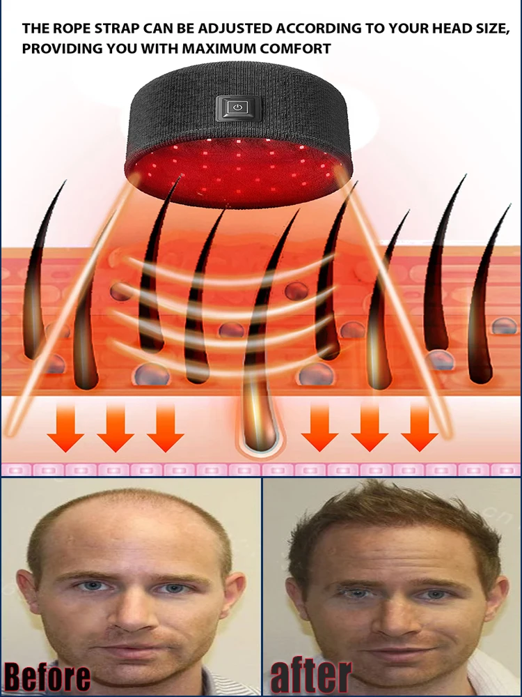 Laser Hair Cap Repairs Frizzy Hair, Thickens Hairline, Solidifies Head Massage, Cares for Damaged Hair, Heat Cap