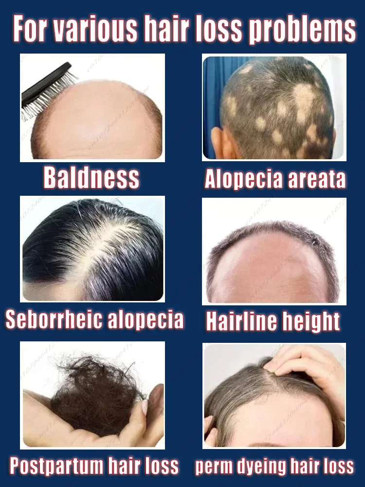 Laser Hair Cap Repairs Frizzy Hair, Thickens Hairline, Solidifies Head Massage, Cares for Damaged Hair, Heat Cap