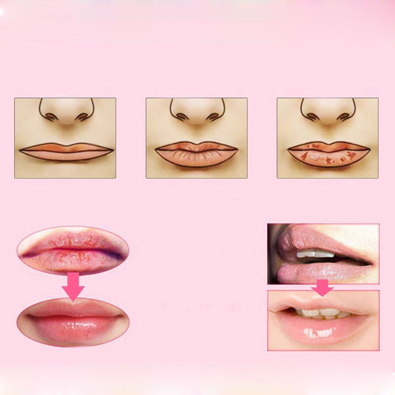 Lip Mask Moisture Pads (Set of 5) Lip Mask Moisture Pads (Set of 5)