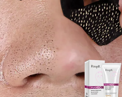 Mango Blackhead Extraction Mask Mango Blackhead Extraction Mask