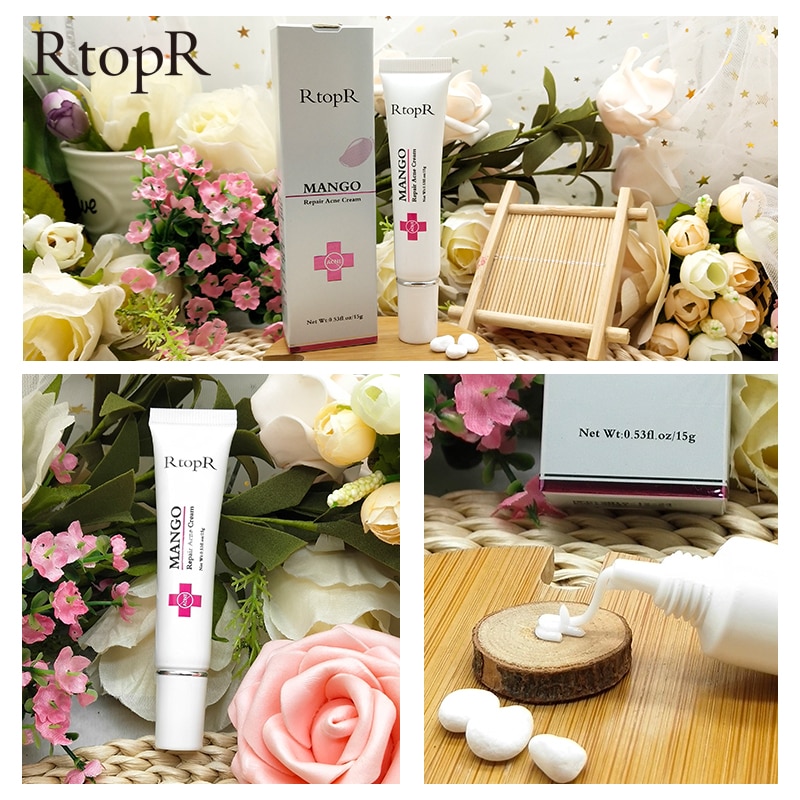 Mango Whitening Cream Acne Treatment