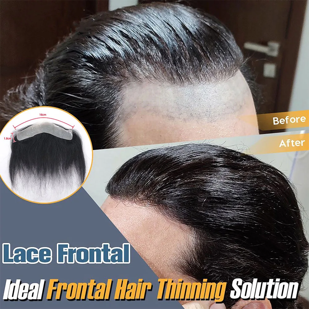 Mens Frontal Toupee V Loop 100% Human Hair Forehead Hairline Patch 0.06mm Thin Skin PU Hairline Men's Capillary Mens Frontal Toupee V Loop 100% Human Hair Forehead Hairline Patch 0.06mm Thin Skin PU Hairline Men's Capillary