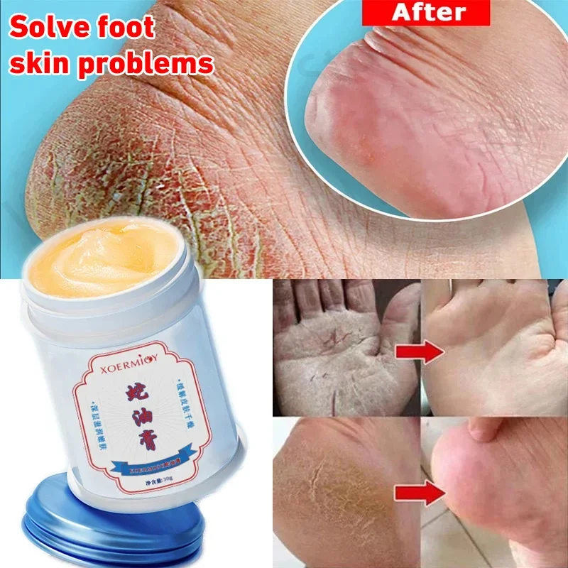 Moisturizing Anti-Drying Crack Foot Cream Hand Feet Care Family Exfoliation Dead Skin Removal Softening Smooth Skin Moisturizing Anti-Drying Crack Foot Cream Hand Feet Care Family Exfoliation Dead Skin Removal Softening Smooth Skin