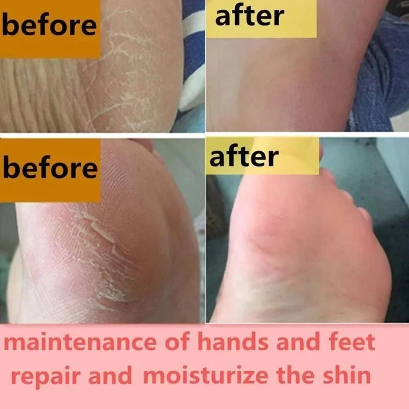 Moisturizing Anti-Drying Crack Foot Cream Hand Feet Care Family Exfoliation Dead Skin Removal Softening Smooth Skin Moisturizing Anti-Drying Crack Foot Cream Hand Feet Care Family Exfoliation Dead Skin Removal Softening Smooth Skin