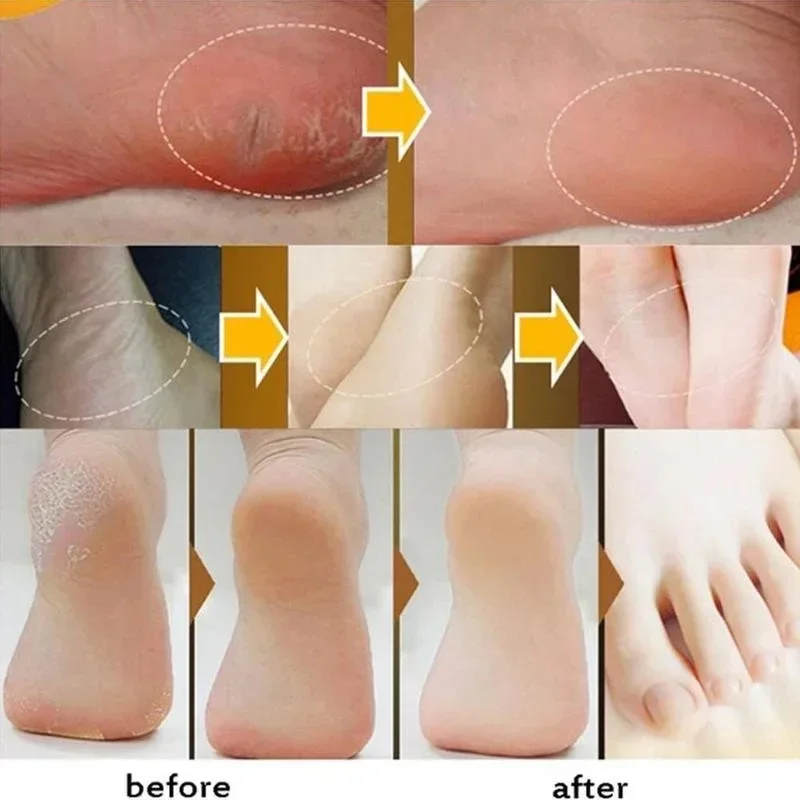 Moisturizing Anti-Drying Crack Foot Cream Hand Feet Care Family Exfoliation Dead Skin Removal Softening Smooth Skin Moisturizing Anti-Drying Crack Foot Cream Hand Feet Care Family Exfoliation Dead Skin Removal Softening Smooth Skin