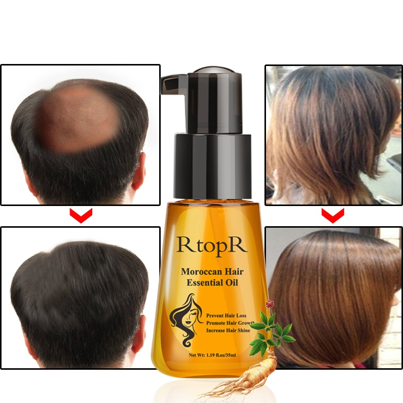Moroccan Hair Oil Hair Care Treatment Moroccan Hair Oil Hair Care Treatment
