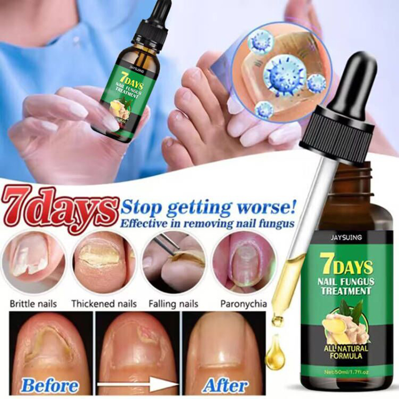 Nail Fungal Treatment Essence Oil Foot Toe Nail Fungus Removal Serum 7 Days Repair Onychomycosi Anti Infection Gel Care Nail Fungal Treatment Essence Oil Foot Toe Nail Fungus Removal Serum 7 Days Repair Onychomycosi Anti Infection Gel Care