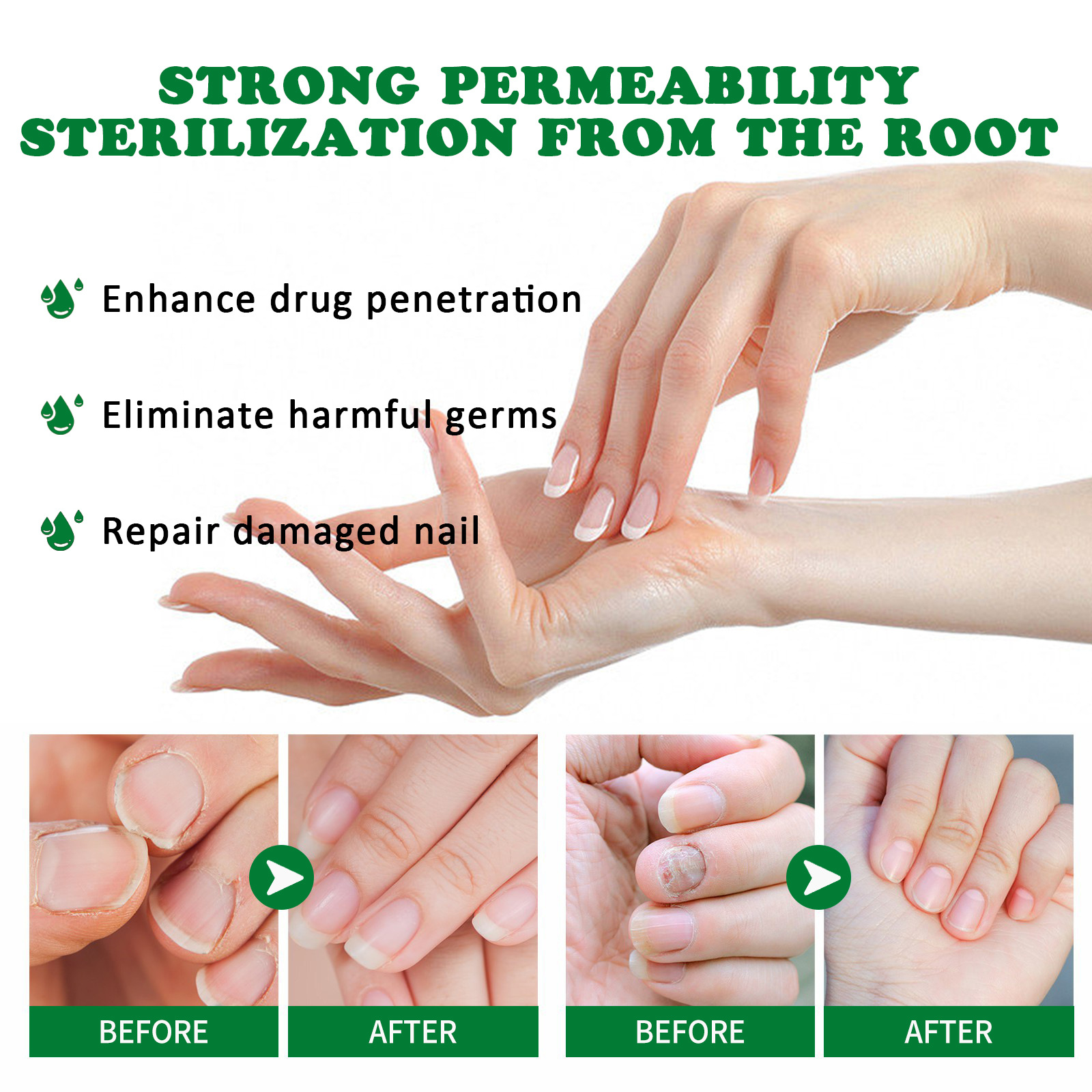 Nail Fungal Treatment Essence Oil Foot Toe Nail Fungus Removal Serum 7 Days Repair Onychomycosi Anti Infection Gel Care Nail Fungal Treatment Essence Oil Foot Toe Nail Fungus Removal Serum 7 Days Repair Onychomycosi Anti Infection Gel Care