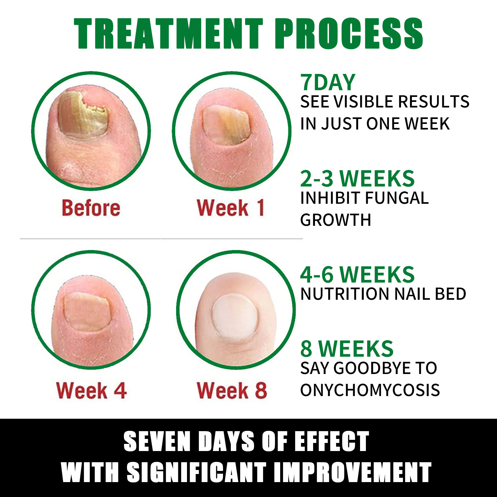 Nail Fungal Treatment Essence Oil Foot Toe Nail Fungus Removal Serum 7 Days Repair Onychomycosi Anti Infection Gel Care Nail Fungal Treatment Essence Oil Foot Toe Nail Fungus Removal Serum 7 Days Repair Onychomycosi Anti Infection Gel Care