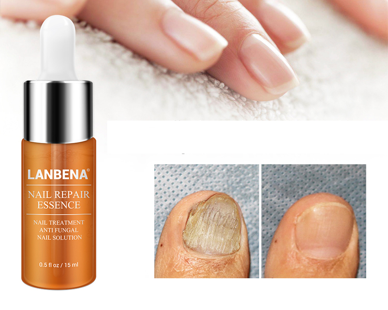 Nail Fungus Treatment Labrena Serum 12ml Nail Fungus Treatment Labrena Serum 12ml