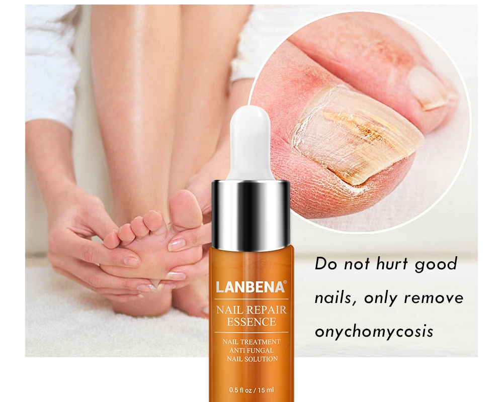 Nail Fungus Treatment Labrena Serum 12ml Nail Fungus Treatment Labrena Serum 12ml