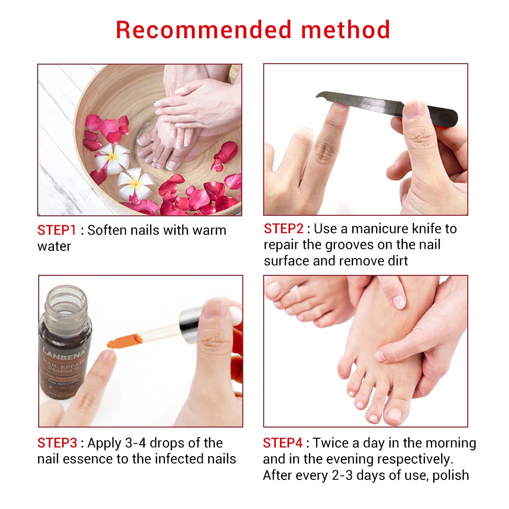 Nail Fungus Treatment Labrena Serum 12ml Nail Fungus Treatment Labrena Serum 12ml