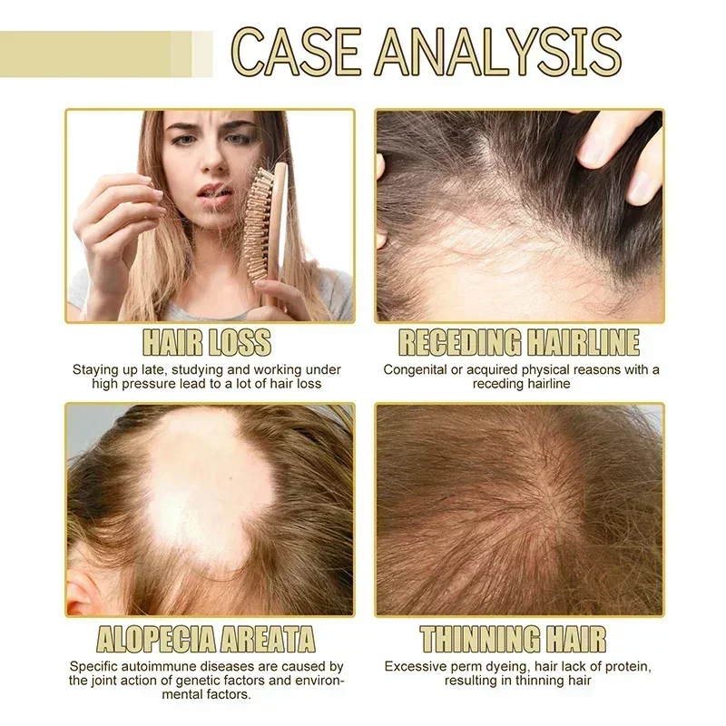 Natural Hair Growth Oil Efficient Anti Hair Loss Nourishing Essential Oil For Dense Repair Damaged Hair Moisturizing Natural Hair Growth Oil Efficient Anti Hair Loss Nourishing Essential Oil For Dense Repair Damaged Hair Moisturizing
