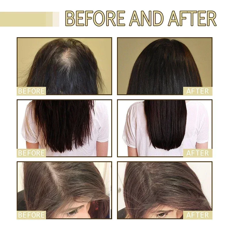 Natural Hair Growth Oil Efficient Anti Hair Loss Nourishing Essential Oil For Dense Repair Damaged Hair Moisturizing Natural Hair Growth Oil Efficient Anti Hair Loss Nourishing Essential Oil For Dense Repair Damaged Hair Moisturizing