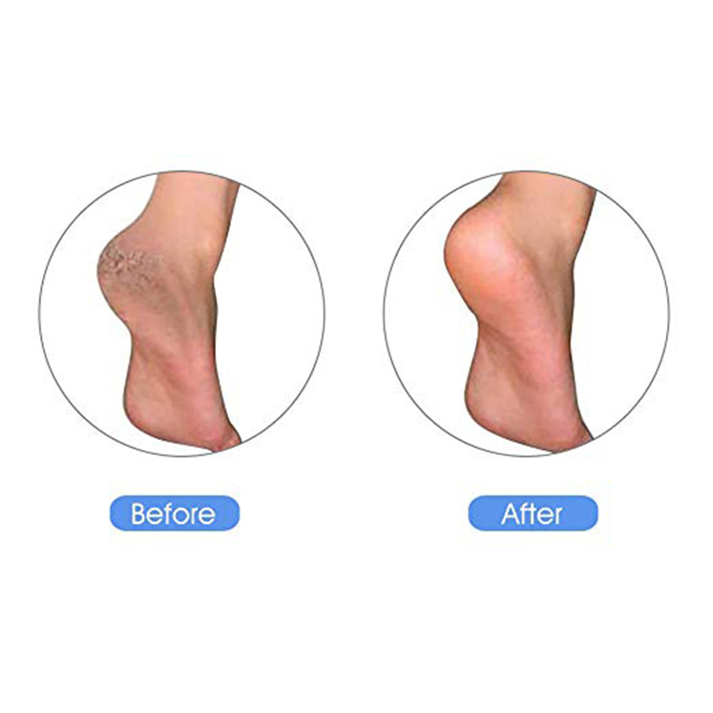 Natural Pumice Stone Foot Clean Skin Grinding Callus Care Massage Tool Dead Hard Remover Pedicure Tools Feet Care