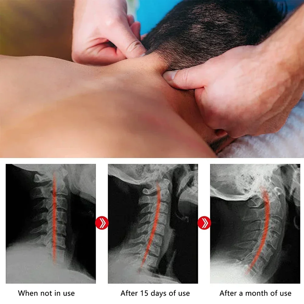 Neck and Shoulder Relaxer with Upper Back Massage Point, Cervical Traction Device Neck Stretcher for TMJ Pain Relief