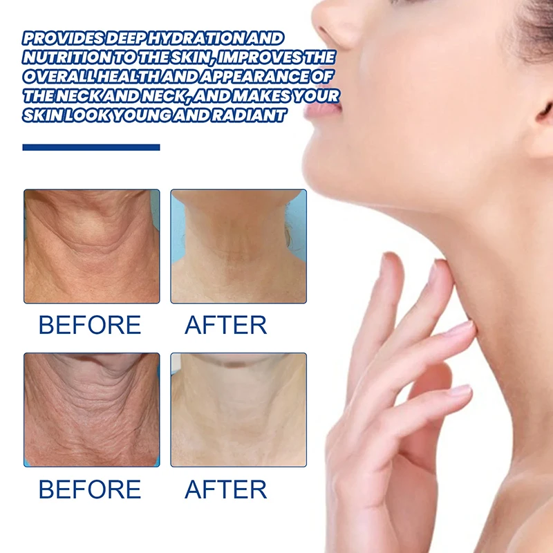 Neck Lines Protein Cream Lift Neck Eliminate Neck Fine Lines Anti-ageing Eliminate Double Chin Moisturis Nourish Neck Lines Protein Cream Lift Neck Eliminate Neck Fine Lines Anti-ageing Eliminate Double Chin Moisturis Nourish